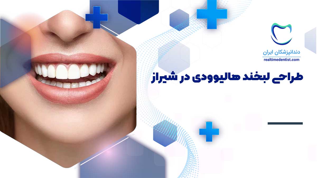 بهترین دکترهای طراحی لبخند هالیوودی در شیراز + آدرس و تلفن و نحوه نوبت دهی