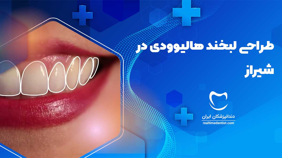 بهترین دندانپزشکان طراحی لبخند هالیوودی در شیراز