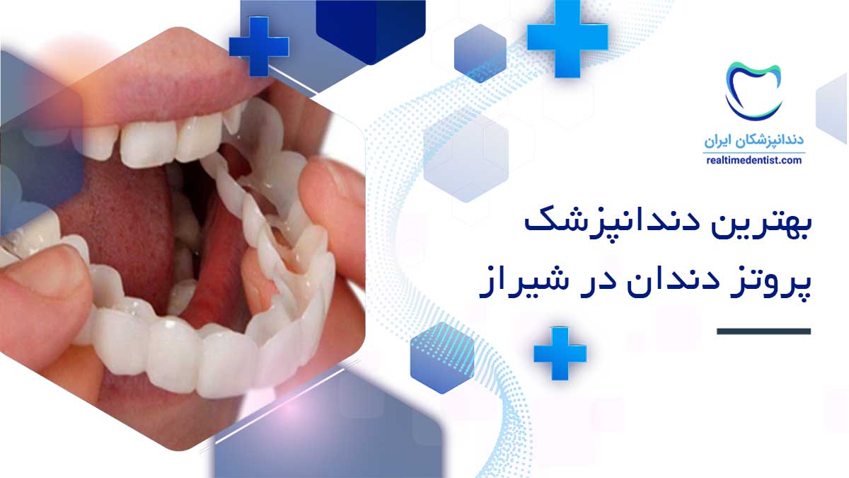 متخصص پروتز دندان در شیراز