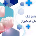 روکش دندان در شیراز