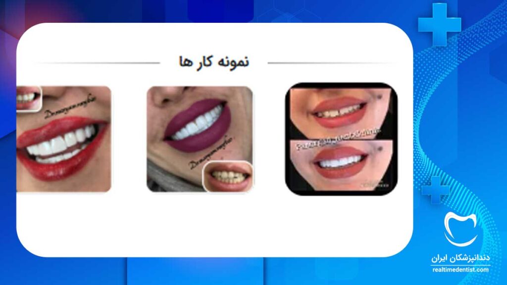 نمونه کار بهترین کلینیک های دندانپزشکی در شیراز