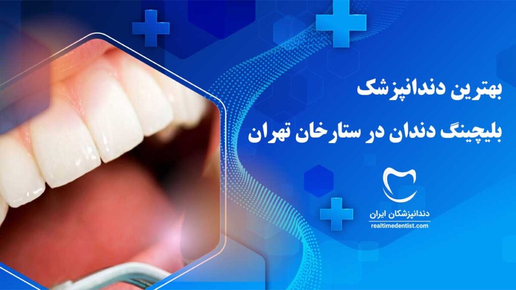 بلیچینگ دندان در ستارخان تهران