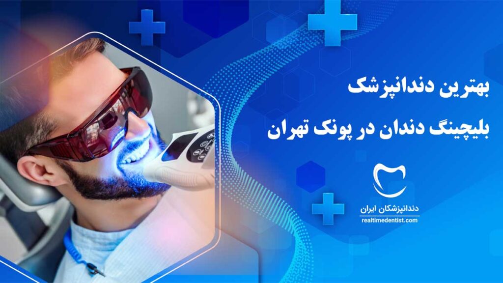 بلیچینگ دندان در پونک تهران