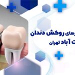آدرس و تلفن بهترین دکترهای روکش دندان در سعادت آباد تهران