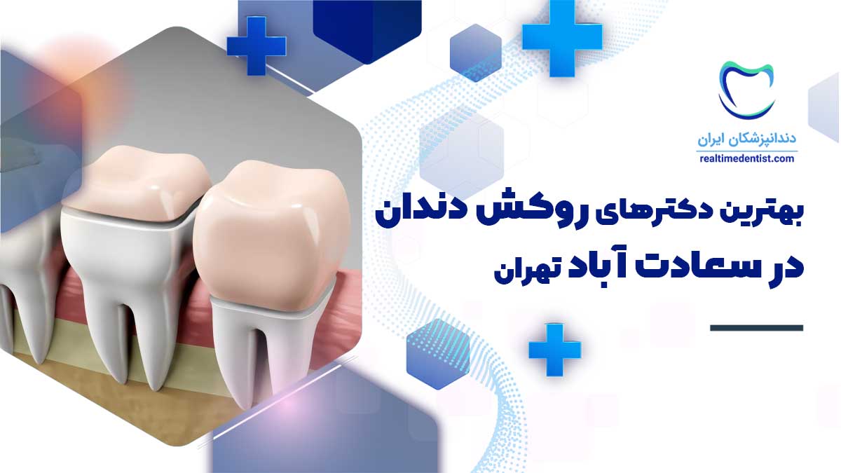 آدرس و تلفن بهترین دکترهای روکش دندان در سعادت آباد تهران