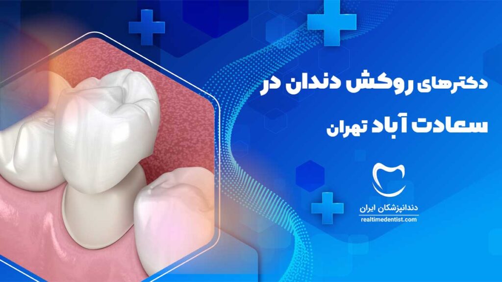 دکترهای روکش دندان در سعادت آباد تهران همراه با هزینه انواع روکش