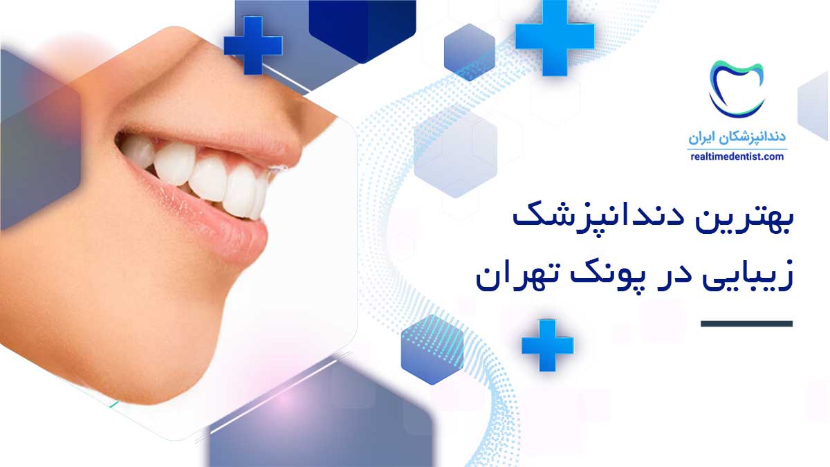 دندانپزشک زیبایی در پونک تهران