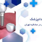 ایمپلنت دندان در صادقیه تهران