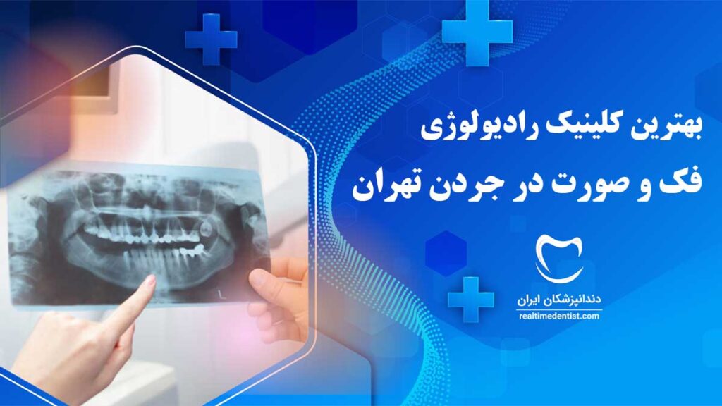 رادیولوژی دهان، فک و صورت در جردن تهران