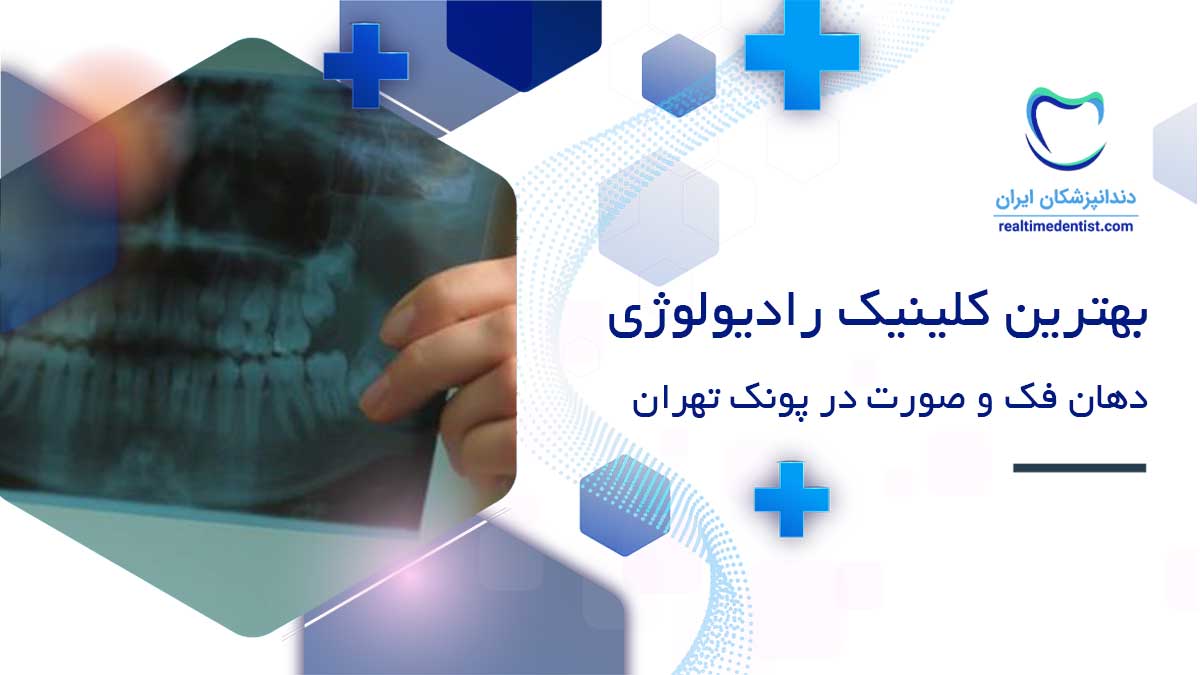 رادیولوژی دهان، فک و صورت در پونک تهران