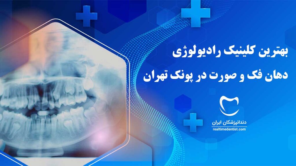 رادیولوژی دهان، فک و صورت در پونک تهران