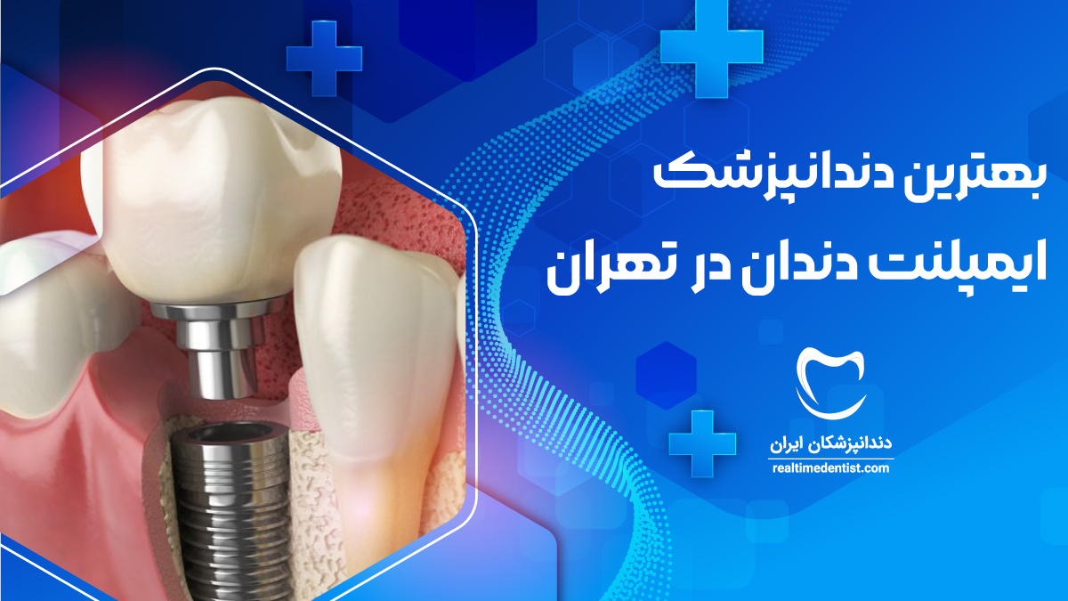 بهترین دندانپزشک ایمپلنت دندان در تهران همراه با نکات مهم انتخاب دندانپزشکان متخصص ایمپلنت در تهران
