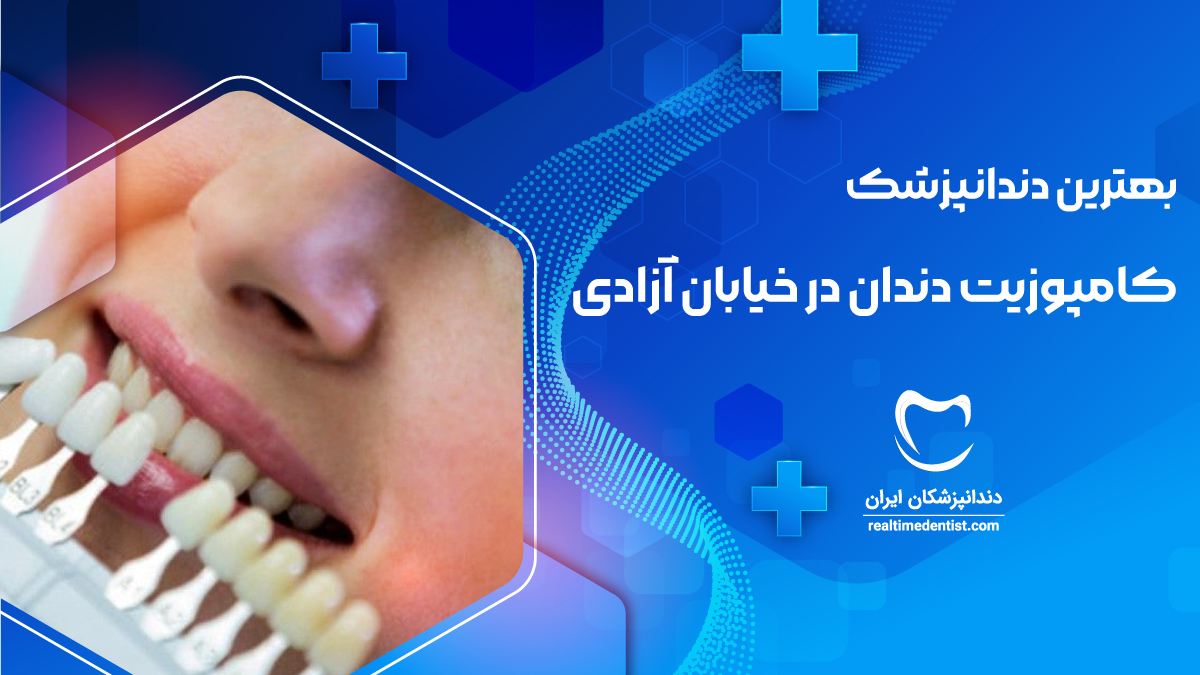 کامپوزیت دندان در خیابان آزادی تهران