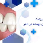 جراحی دندان نهفته در ظفر تهران