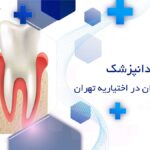 ایمپلنت دندان در اختیاریه تهران