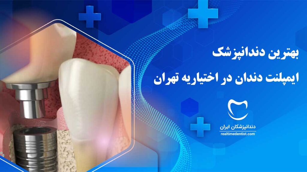 ایمپلنت دندان در اختیاریه تهران