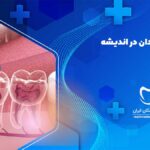 عصب کشی دندان در اندیشه