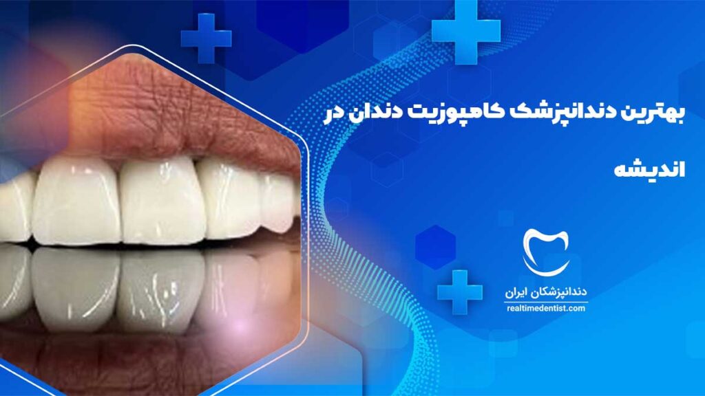 عصب کشی دندان در اندیشه