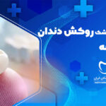 روکش دندان در اندیشه