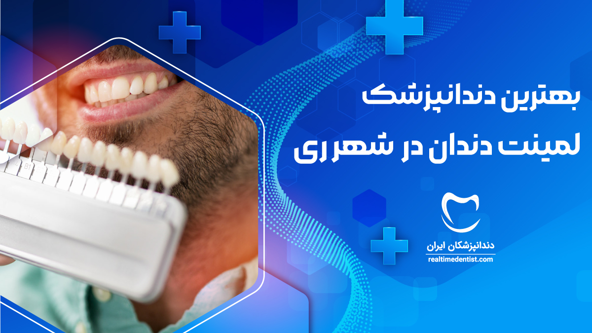 دندانپزشک لمینت دندان در شهر ری