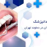 دندانپزشک ایمپلنت دندان در دماوند تهران