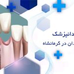 بهترین متخصص ایمپلنت در کرمانشاه