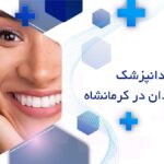 بهترین متخصص لمینت دندان در کرمانشاه