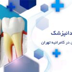 دندانپزشک ایمپلنت دندان در کامرانیه تهران