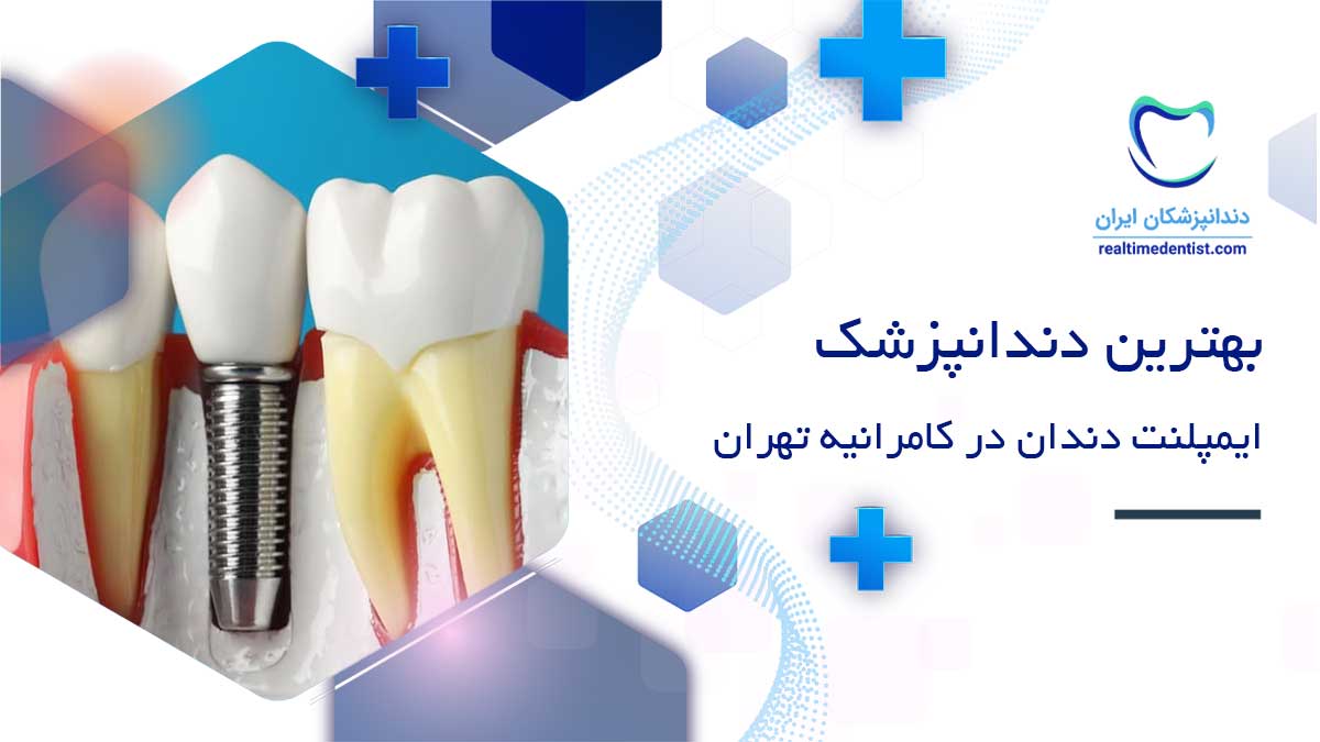 دندانپزشک ایمپلنت دندان در کامرانیه تهران