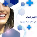 لمینت دندان در کامرانیه تهران