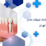 دندانپزشک ایمپلنت دندان در استاد معین تهران