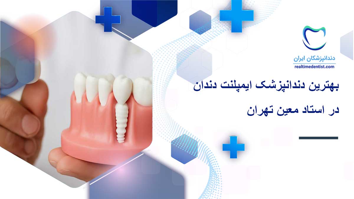 دندانپزشک ایمپلنت دندان در استاد معین تهران