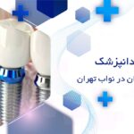 دندانپزشک ایمپلنت دندان در نواب تهران