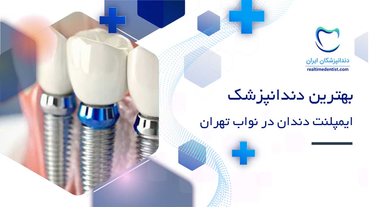 دندانپزشک ایمپلنت دندان در نواب تهران