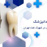 دندانپزشک ایمپلنت دندان در شهرک نفت تهران