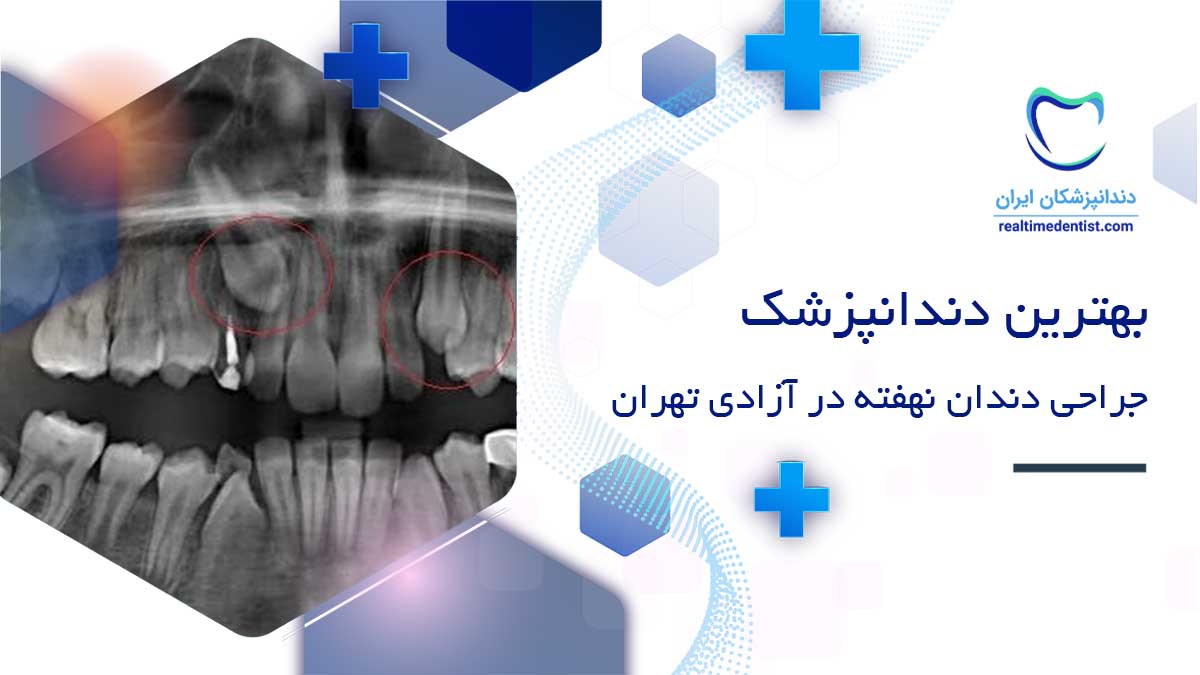 دندانپزشک متخصص جراحی دندان نهفته در آزادی تهران