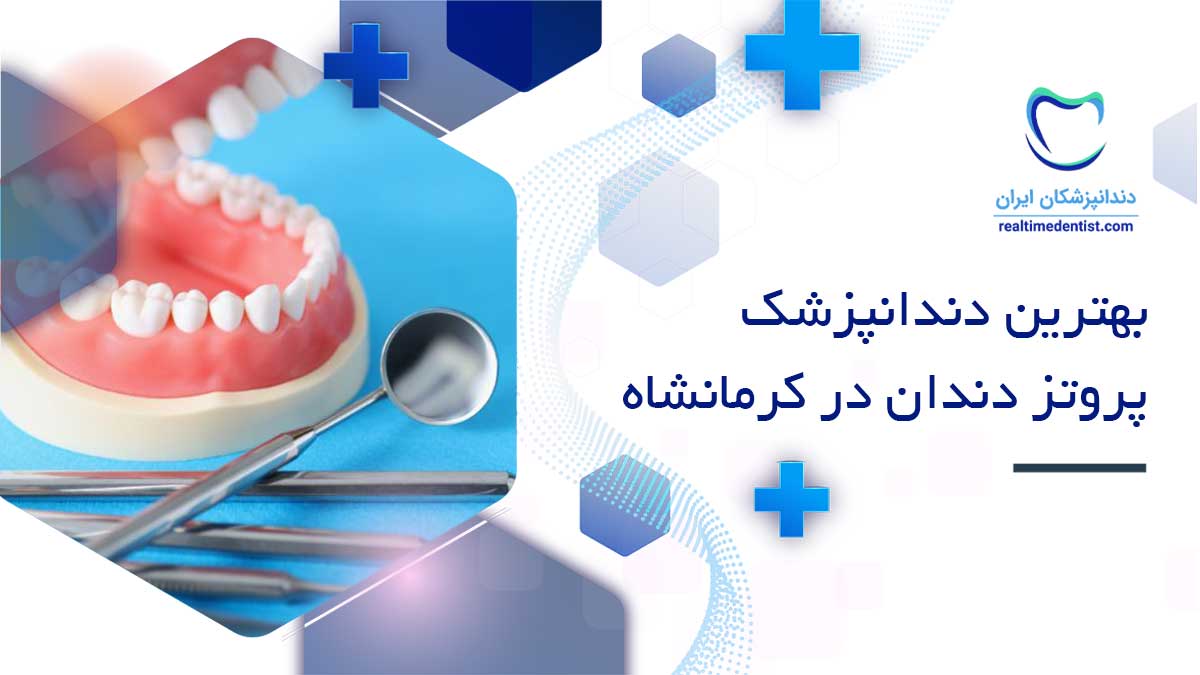 بهترین متخصص پروتز های دندانی در کرمانشاه