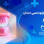 نوبت دهی دندانپزشک متخصص ارتودنسی دندان در چابهار