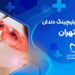 نوبت دهی بهترین دندانپزشک بلیچینگ دندان در فلاح تهران