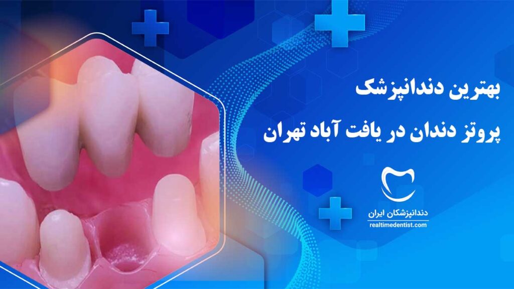 بهترین دندانپزشک متخصص پروتز دندان در یافت آباد تهران