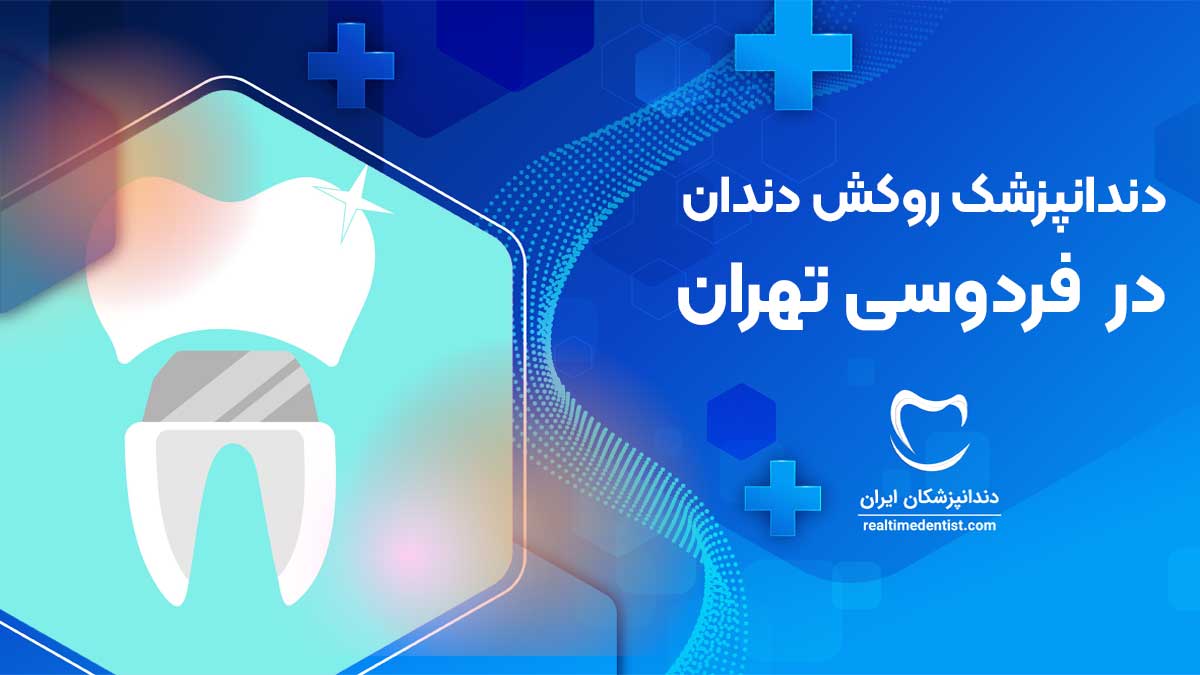 بهترین دندانپزشک روکش دندان در فردوسی تهران