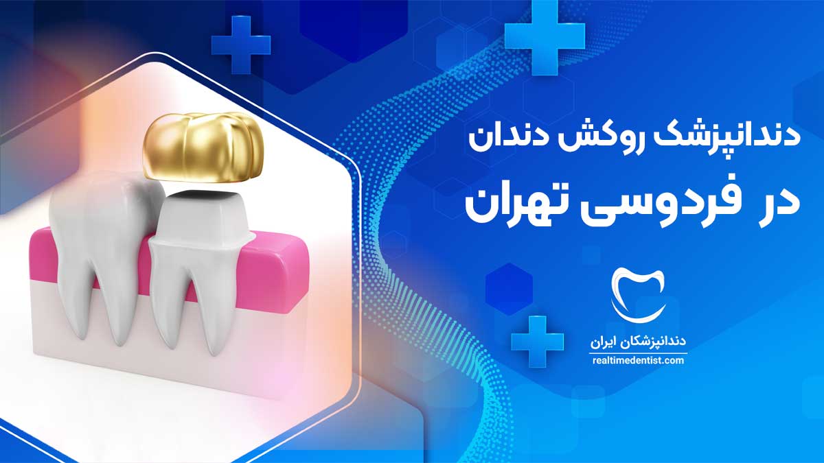 بهترین دندانپزشک روکش دندان در فردوسی تهران