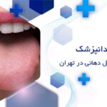 بهترین متخصص زگیل دهانی در تهران