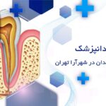 عصب کشی دندان در شهرآرا تهران