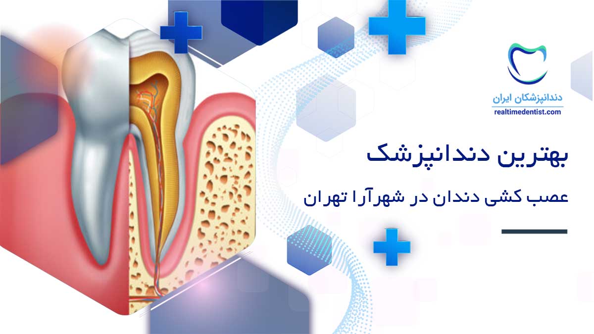 عصب کشی دندان در شهرآرا تهران