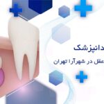 جراحی دندان عقل در شهرآرا تهران