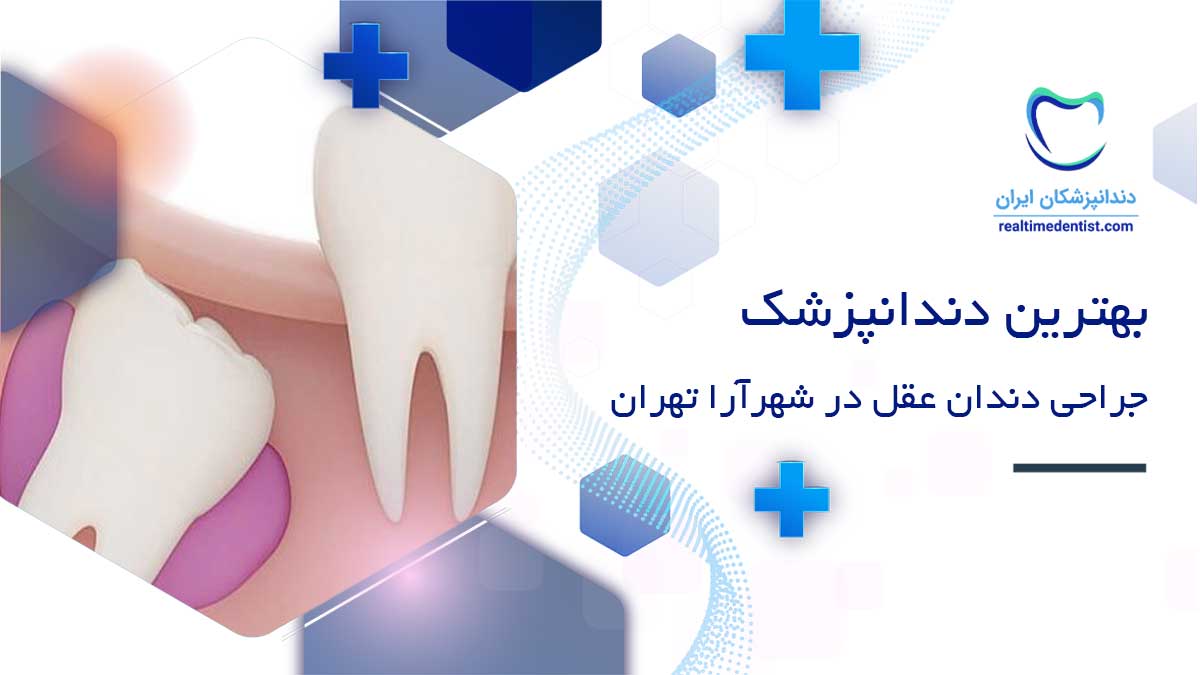 جراحی دندان عقل در شهرآرا تهران
