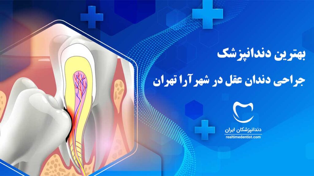 جراحی دندان عقل در شهرآرا تهران
