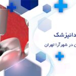 پر کردن دندان در شهرآرا تهران