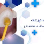 دکتر لمینت دندان اقساطی در جهانشهر کرج
